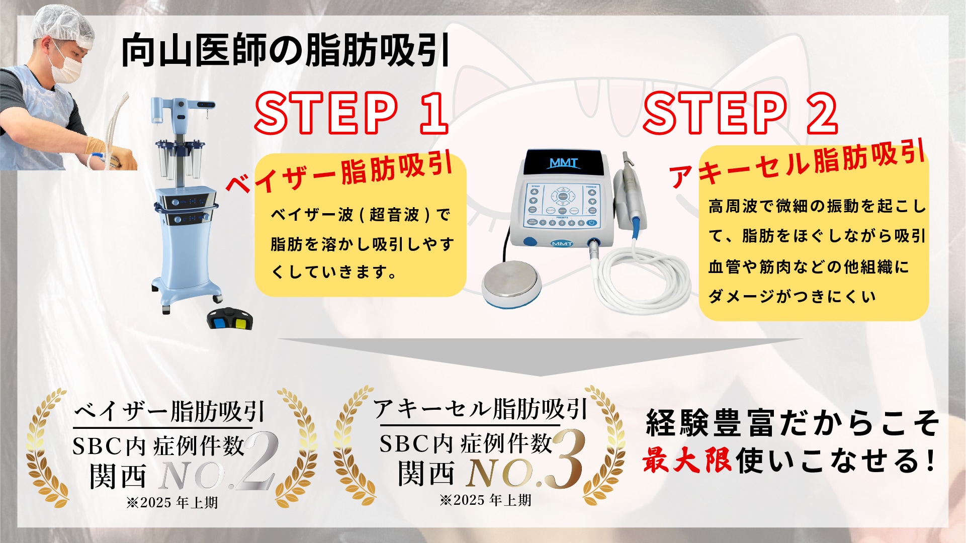 吸引機器にこだわる！