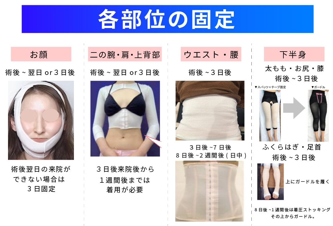 Q. 顔の脂肪吸引後、フェイスバンドは何日間つける必要がありますか？