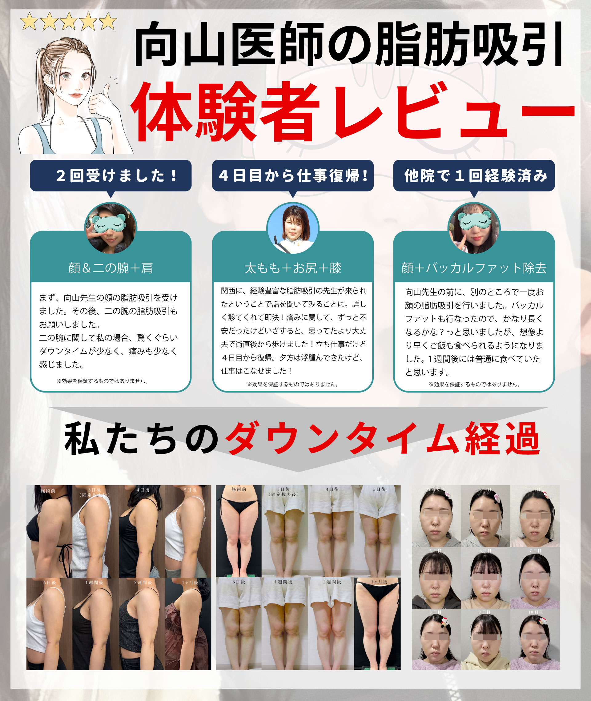 美容外科医を選ぶプロ！目の肥えた湘南美容クリニック社員に選ばれ、順番待ちされる向山医師