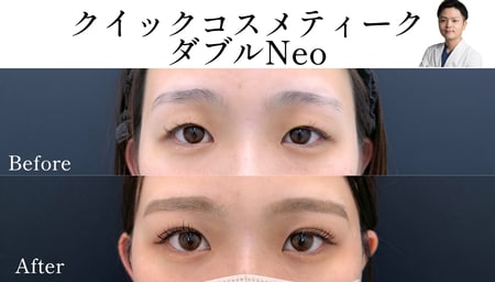 一重にお悩みのお客様