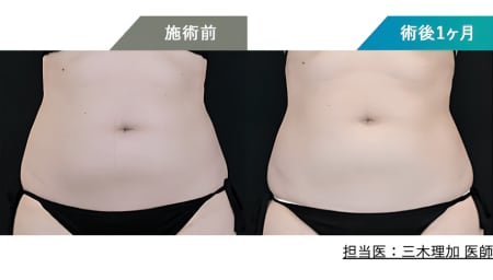 ＼ ウエストラインが引き締まり、さらに女性らしいくびれに ／
