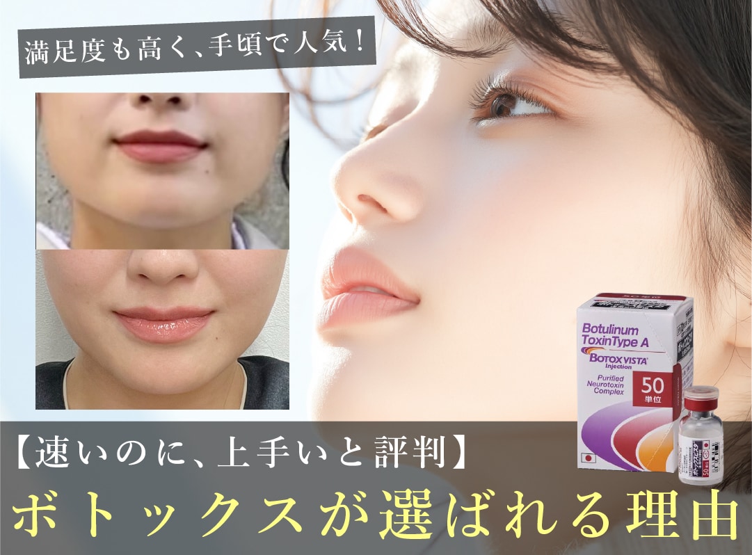 【ボトックスが上手いと大阪で話題】湘南美容クリニック大阪堺東院が選ばれる理由 | おでこや眉間のシワ・エラのハリ、多汗症に人気