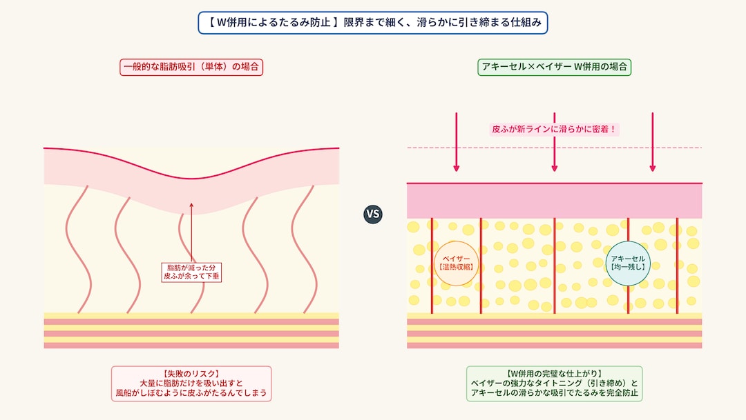 ② 根こそぎの細さと、皮膚のたるみ防止（タイトニング）を完璧に両立