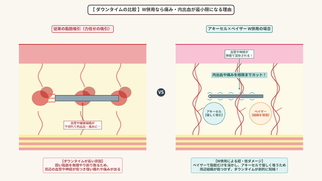 ③ 血管や神経を徹底保護するため、術後の痛み・腫れ・内出血が最小限に