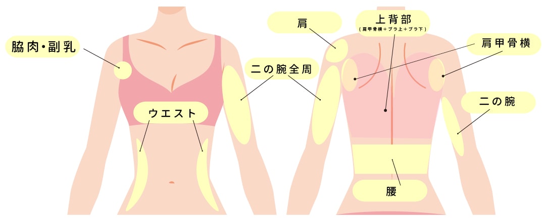 1. 振袖部分だけでなく「肩・肩甲骨横」まで360度セットで吸引