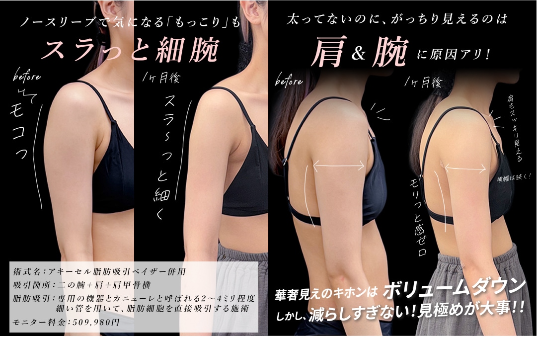 画像の説明を記載