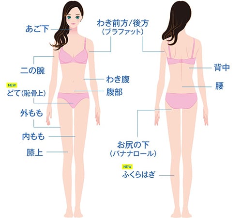 【脂肪除去率20%】脂肪を凍らせて破壊！