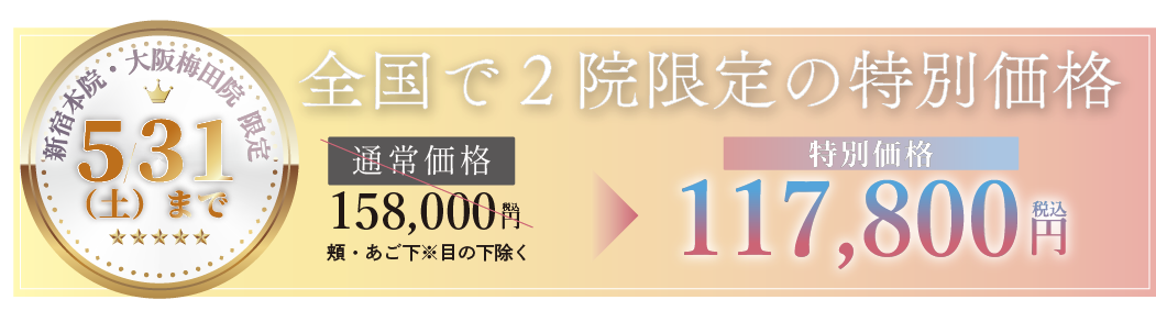 【 期間限定価格 】<br />
ソフウェーブ