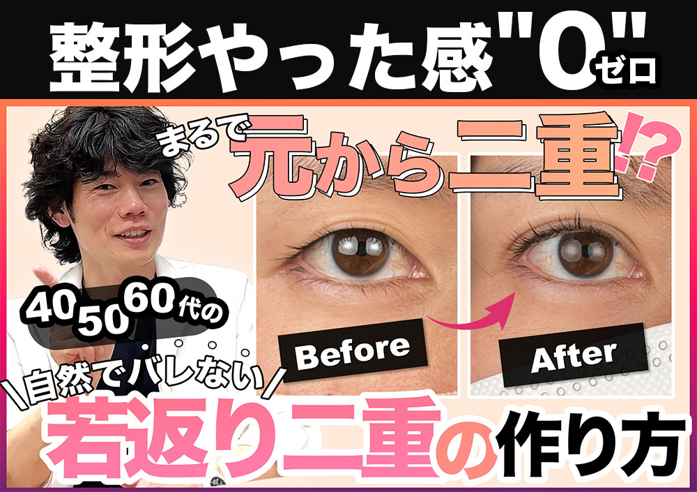 【40代・50代・60代二重整形】元から二重のような自然でバレない二重の作り方