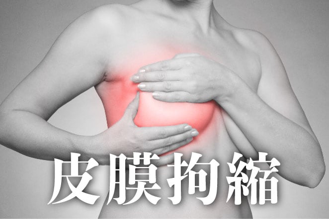 2.皮膜拘縮