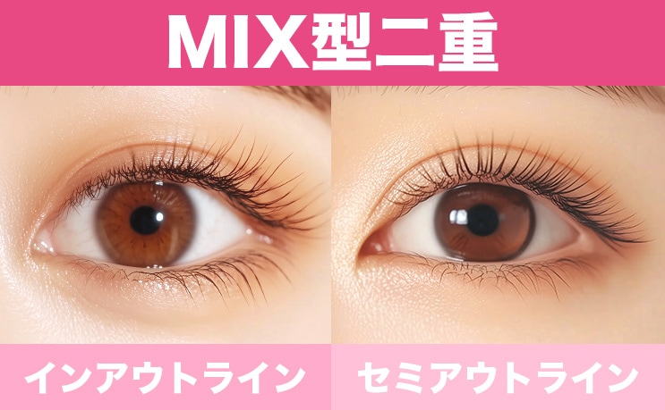 韓国で今人気なのは「MIX型」