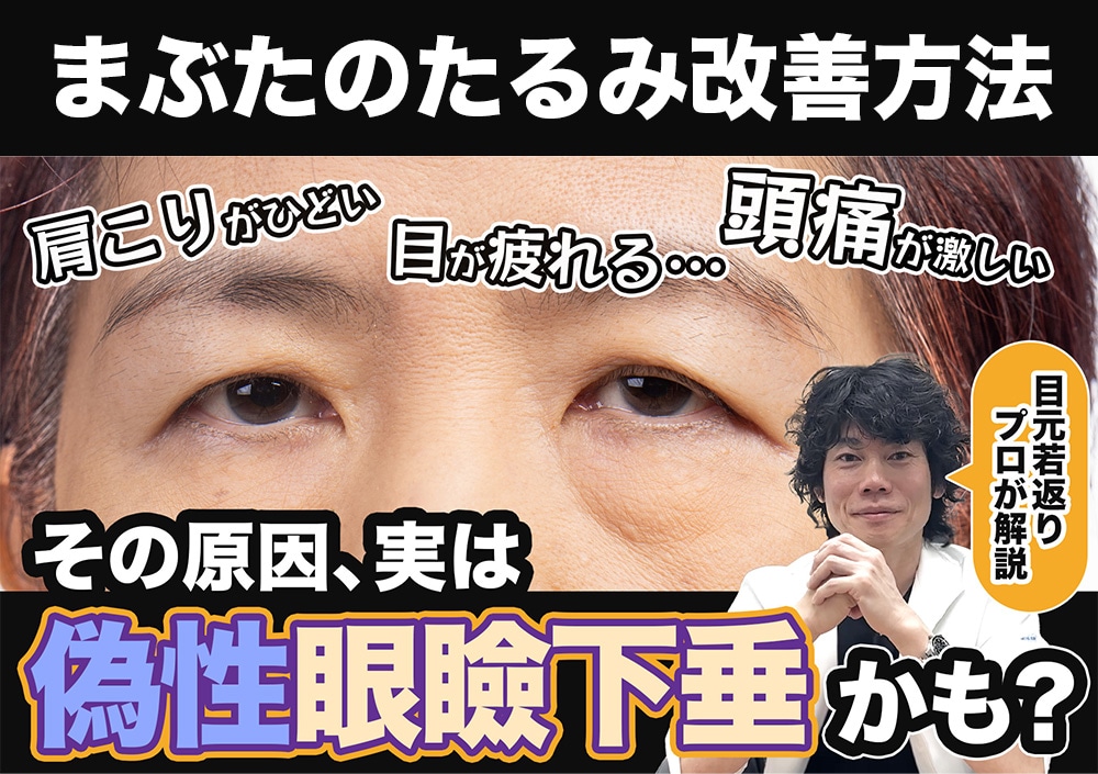 【まぶたのたるみ改善】これって眼瞼下垂?目の疲れ・肩こり・頭痛解消の原因と対処法を究明!