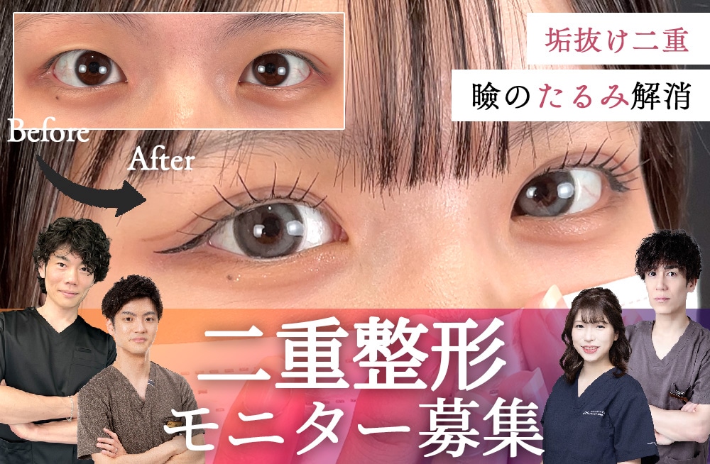 二重のプロフェッショナルドクター達による★二重モニター募集