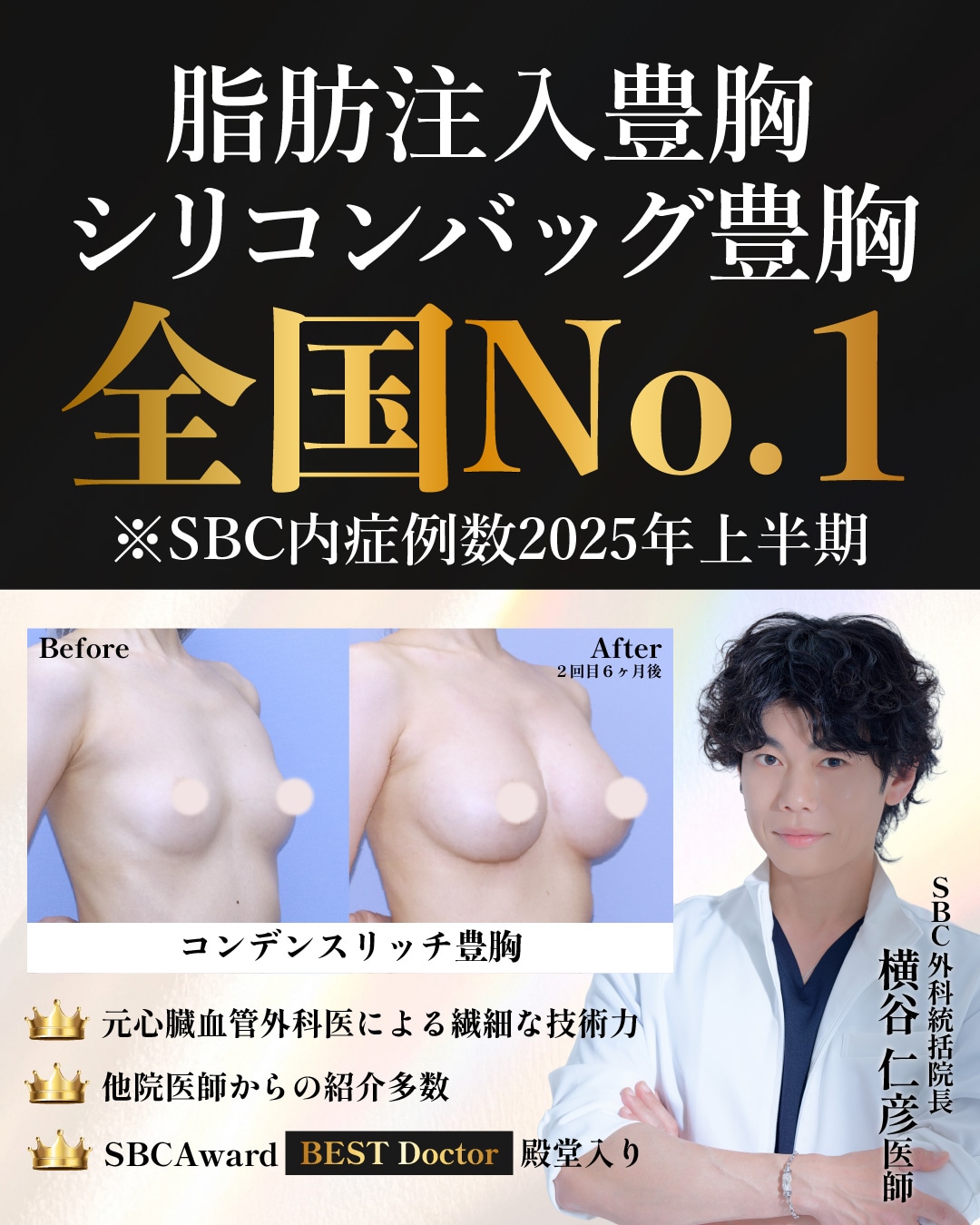 豊胸なら横谷医師にお任せ