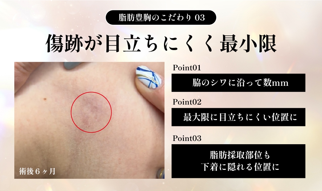 傷跡が目立ちにくく最小限