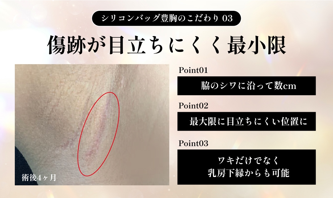 傷跡が目立ちにくく最小限