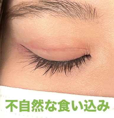 不自然な食い込み