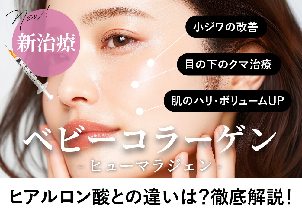 【症例あり】新治療！目周りのクマ・小じわ改善★ベビーコラーゲン★ヒアルロン酸注入との違いを解説！