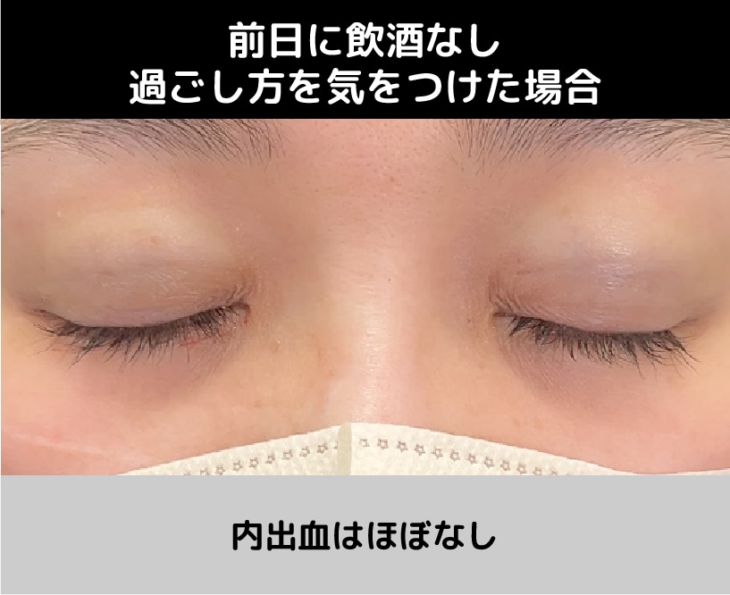 前日に飲酒なし、過ごし方を気をつけた場合の内出血<br />
