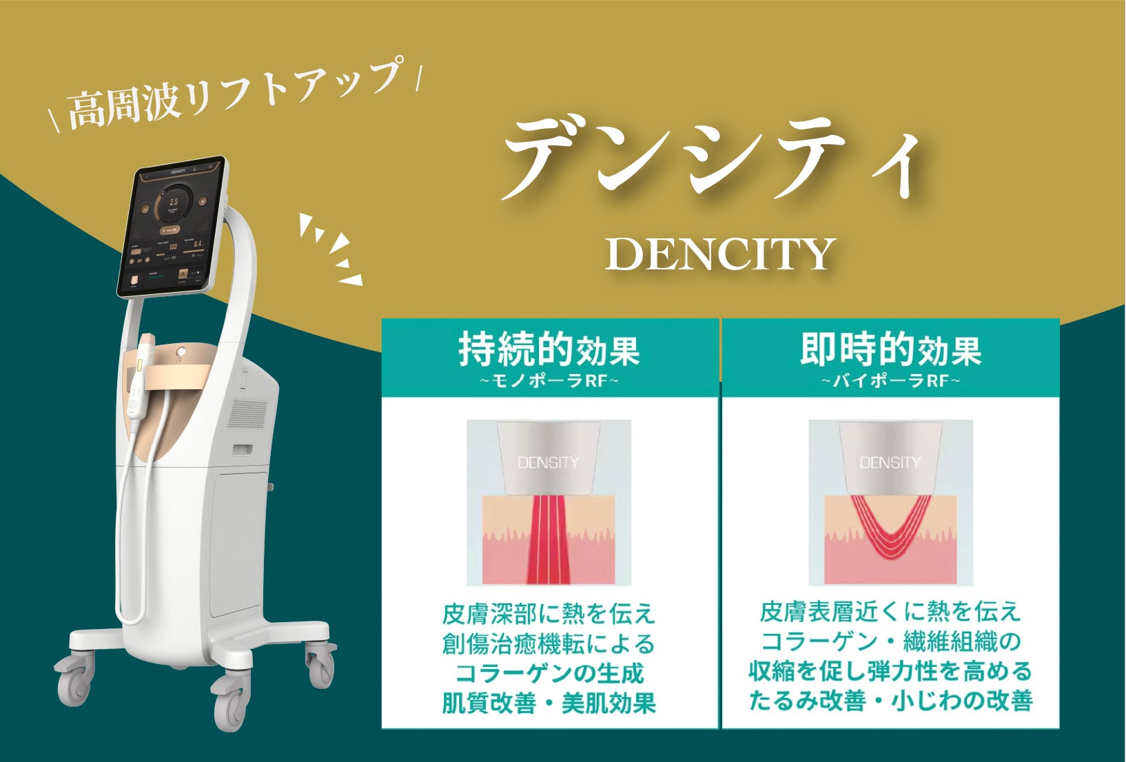 高周波(RF)リフトアップ治療でシワ・たるみ・肌質改善