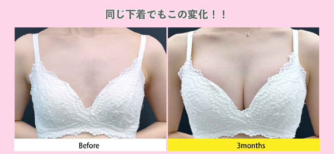 3ヶ月後の仕上がり