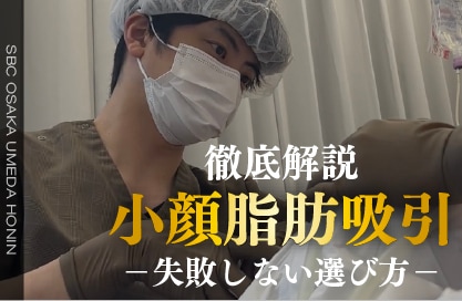大阪梅田の小顔脂肪吸引・徹底解説｜失敗しない選び方【SBC大阪梅田本院】