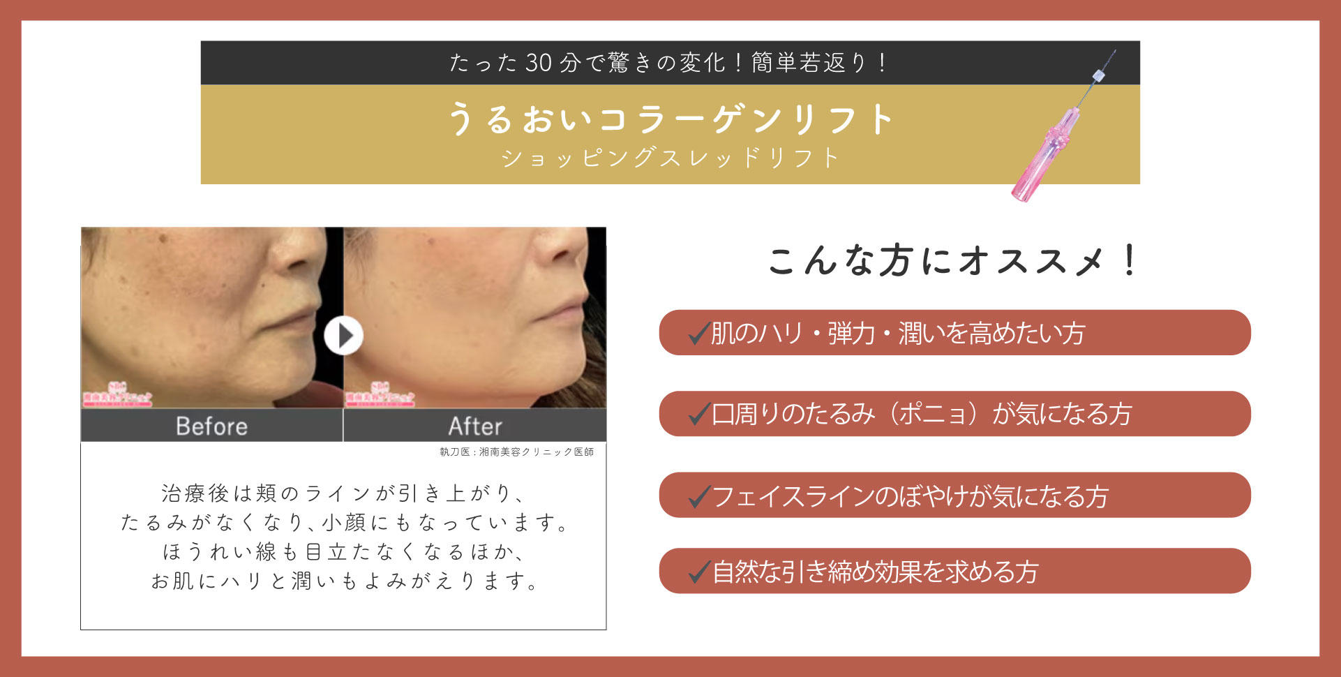 口横のポニョ皮膚スッキリ✨