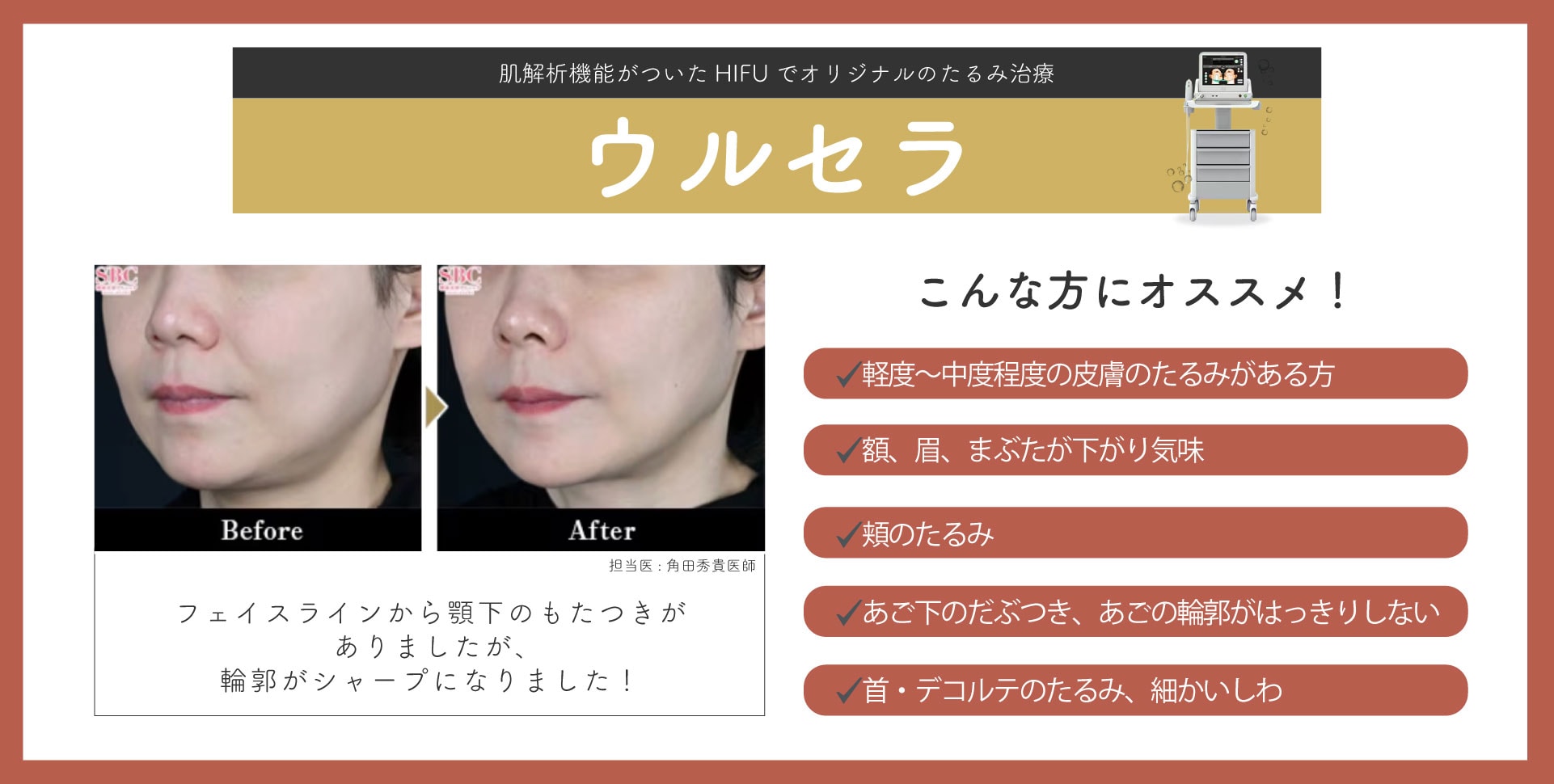 リフトアップ治療のゴールドスタンダード💛