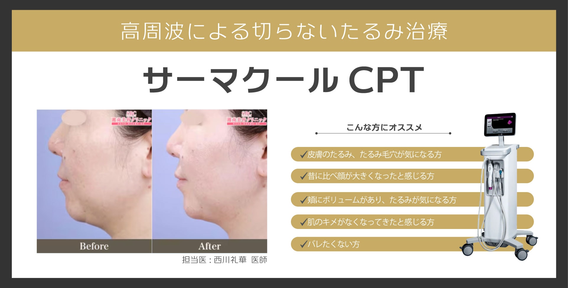 サーマクールCPT