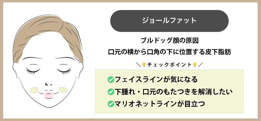 口横のもたつき・ブルドッグ顔の原因「ジョールファット」