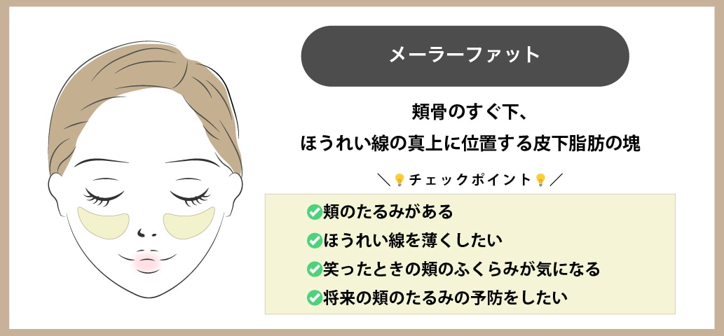 笑った時に盛り上がる頬の肉「メーラーファット」