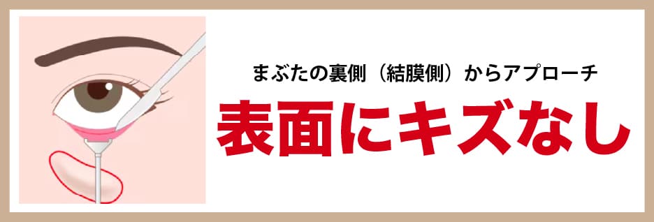 表面に傷を作らない