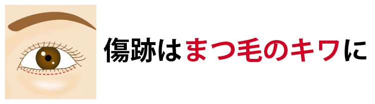 傷跡はまつ毛の際に