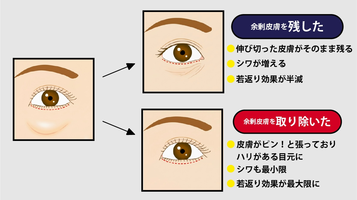 余分な皮膚は物理的に切除した方が若返る可能性も！