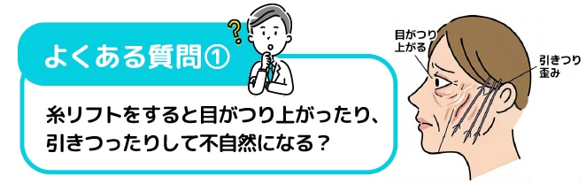 糸リフトをすると、目がつり上がったり、引きつったりして不自然になりませんか？