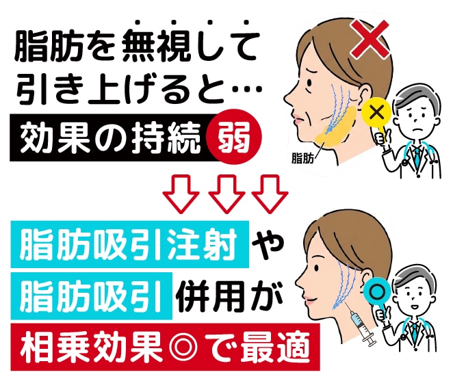②脂肪を無視した糸リフトでの引き上げでは効果が持続しにくい
