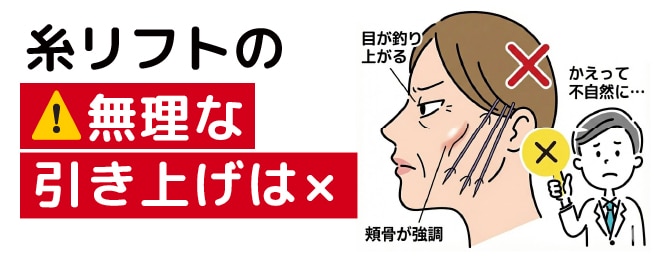 ③糸リフトによる無理な引き上げはかえって不自然