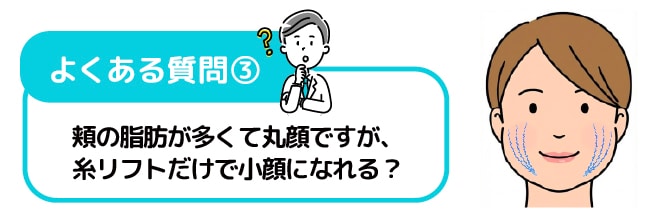 頬の脂肪が多くて丸顔なのですが、糸リフトだけで小顔になれますか？