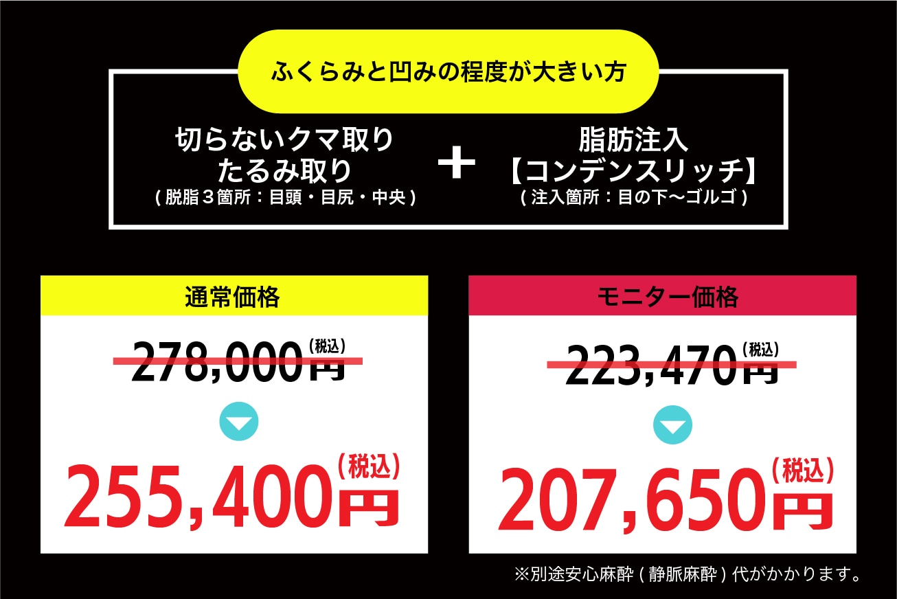 脱脂と脂肪注入の料金