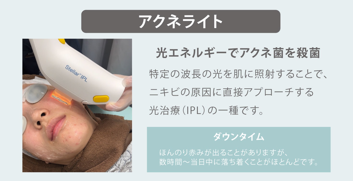 赤ニキビには“アクネライト”