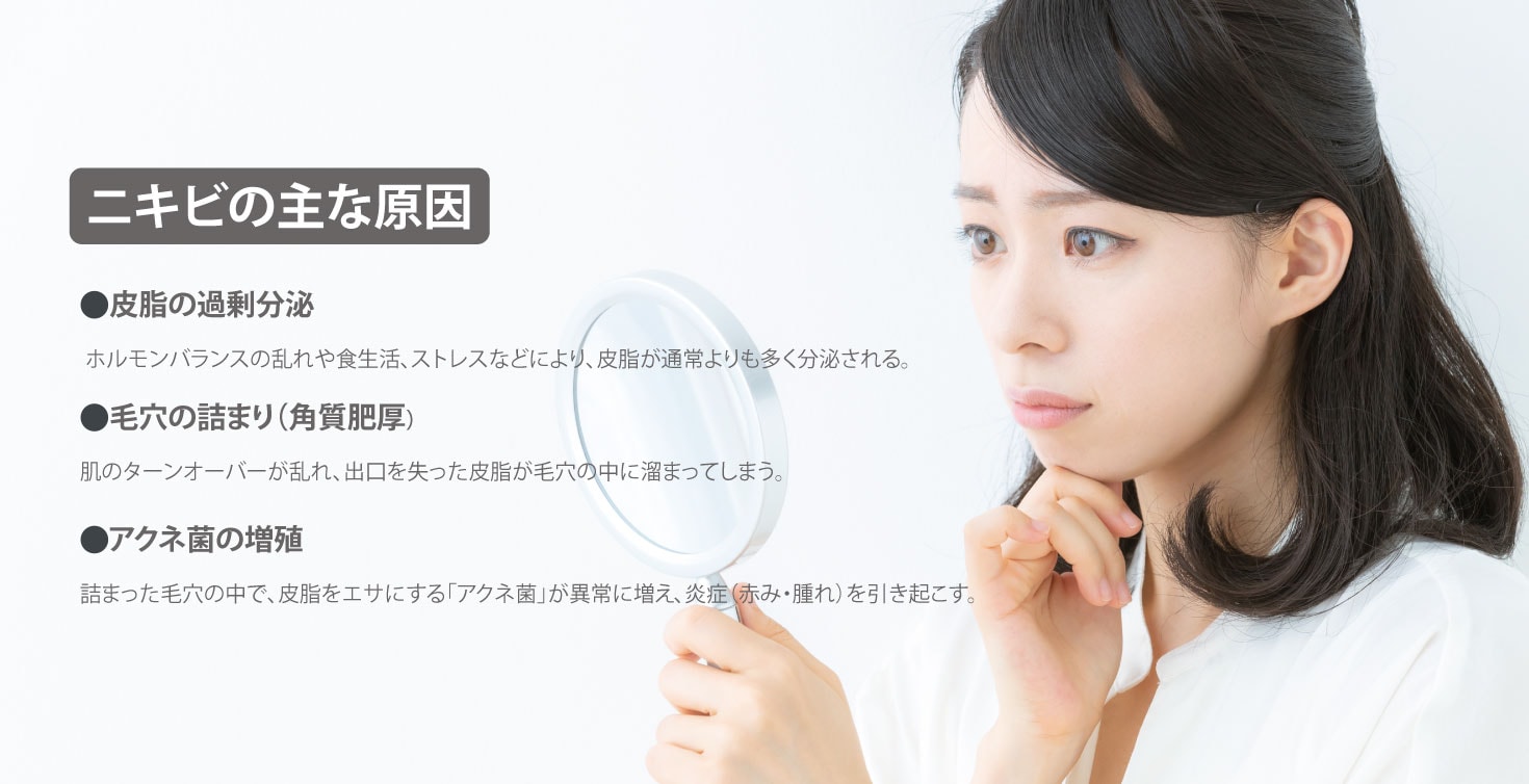ニキビができる主な3つの原因<br />
