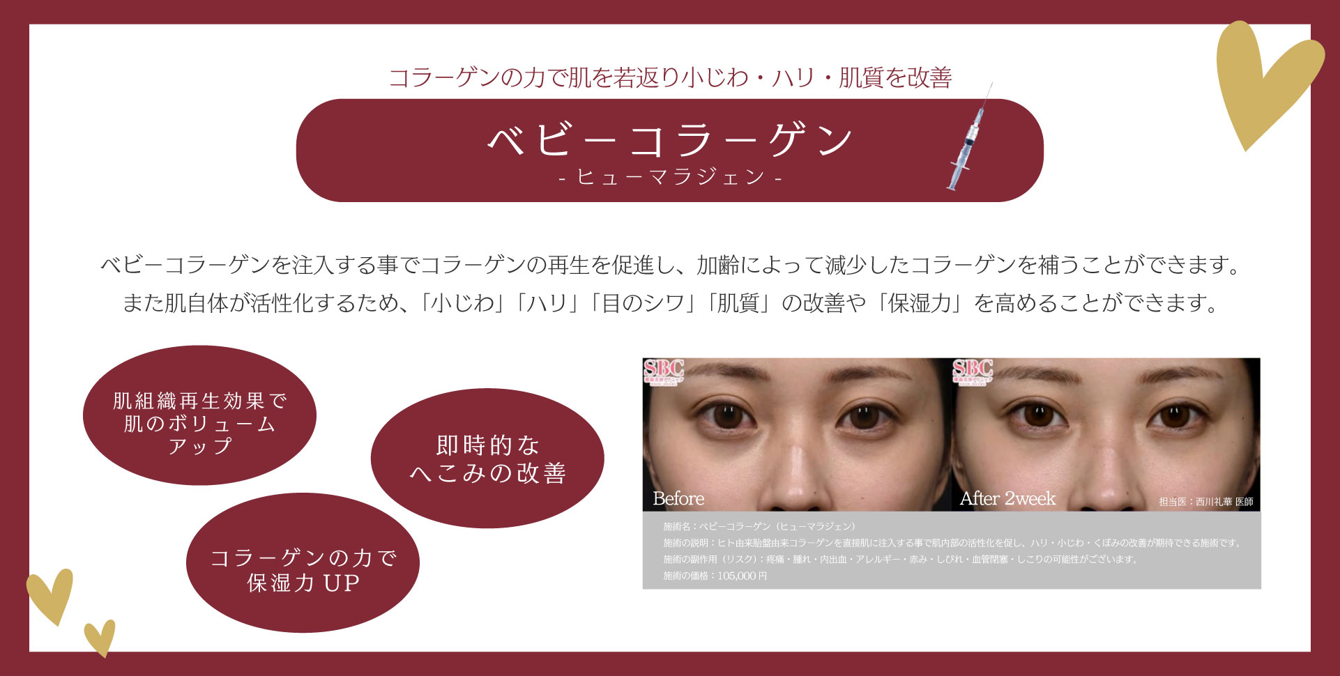 コラーゲンの力で肌を若返り小じわ・ハリ・肌質を改善✨