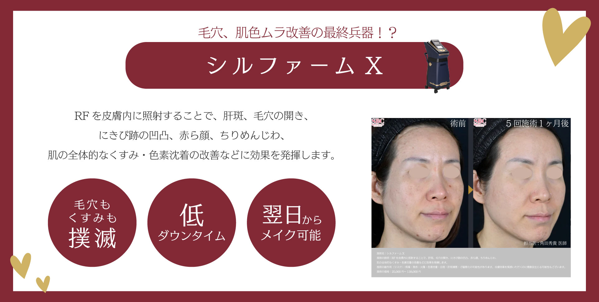 毛穴、肌色ムラ改善の最終兵器！？