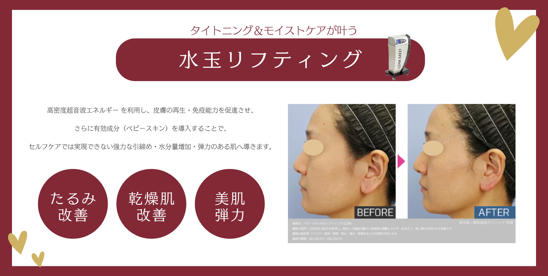 タイトニング＆モイストケアが叶う