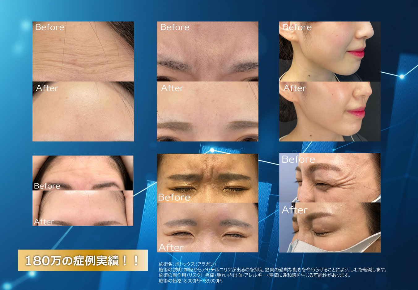 ②180万件以上の症例実績