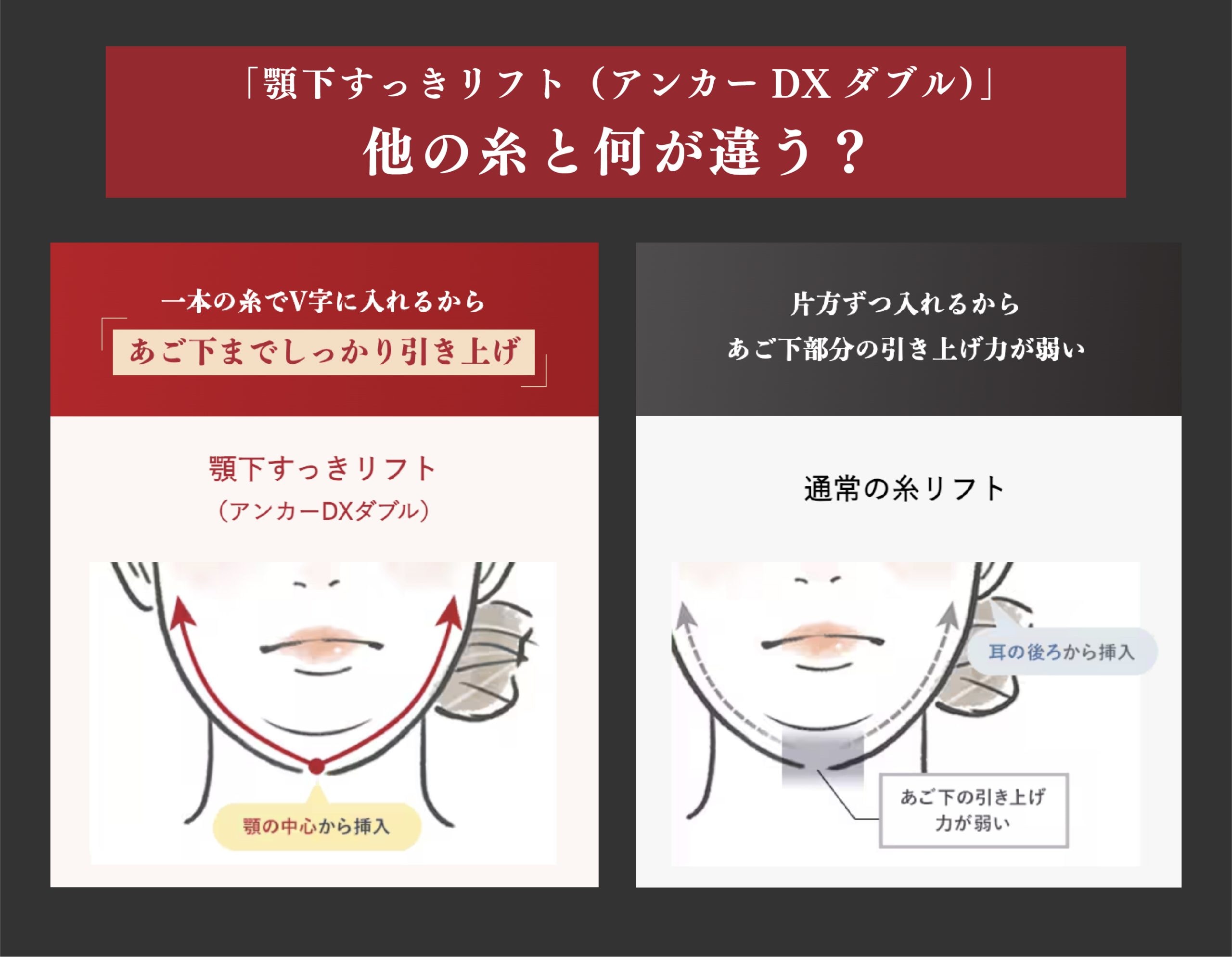 どんな違いがある？