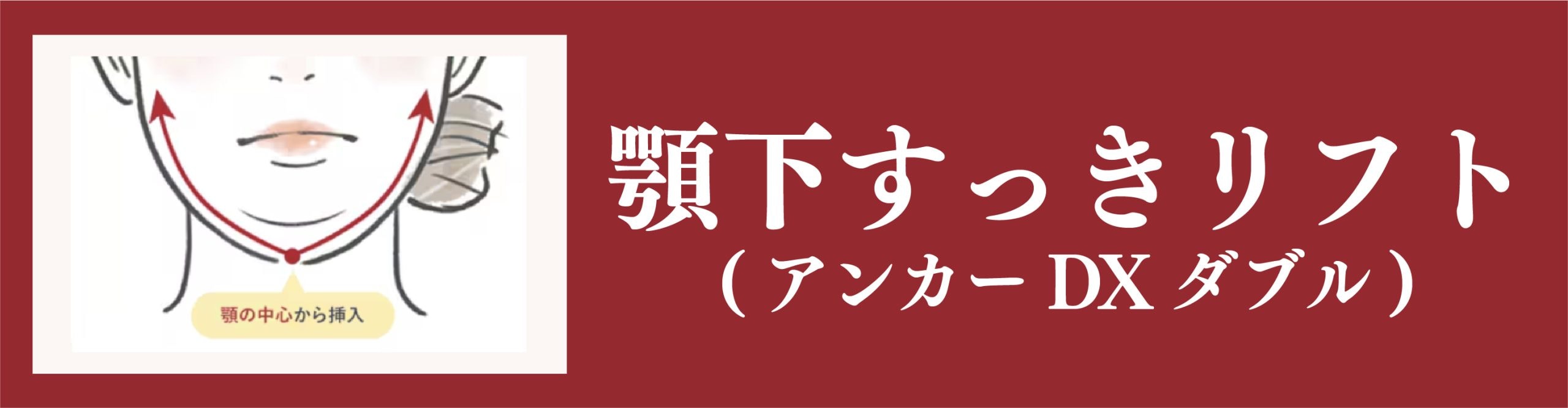 顎下すっきリフト(アンカーDXダブル)