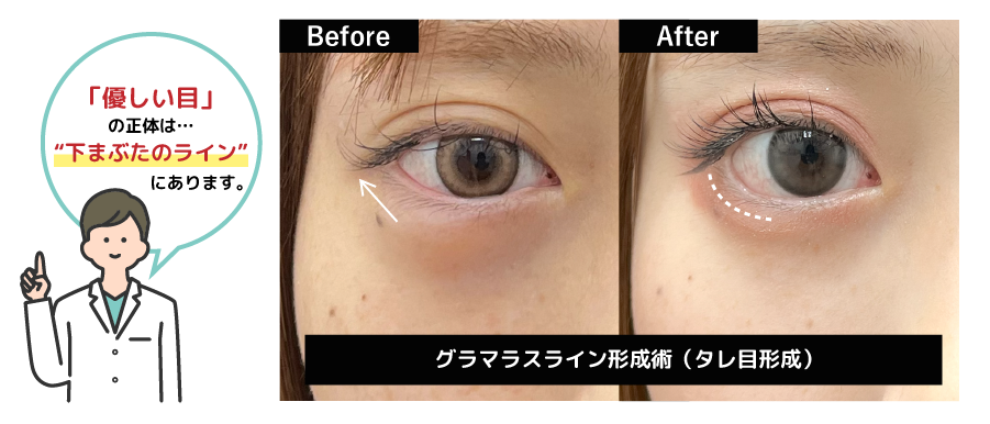 「きつい目」と「優しい目」の違い