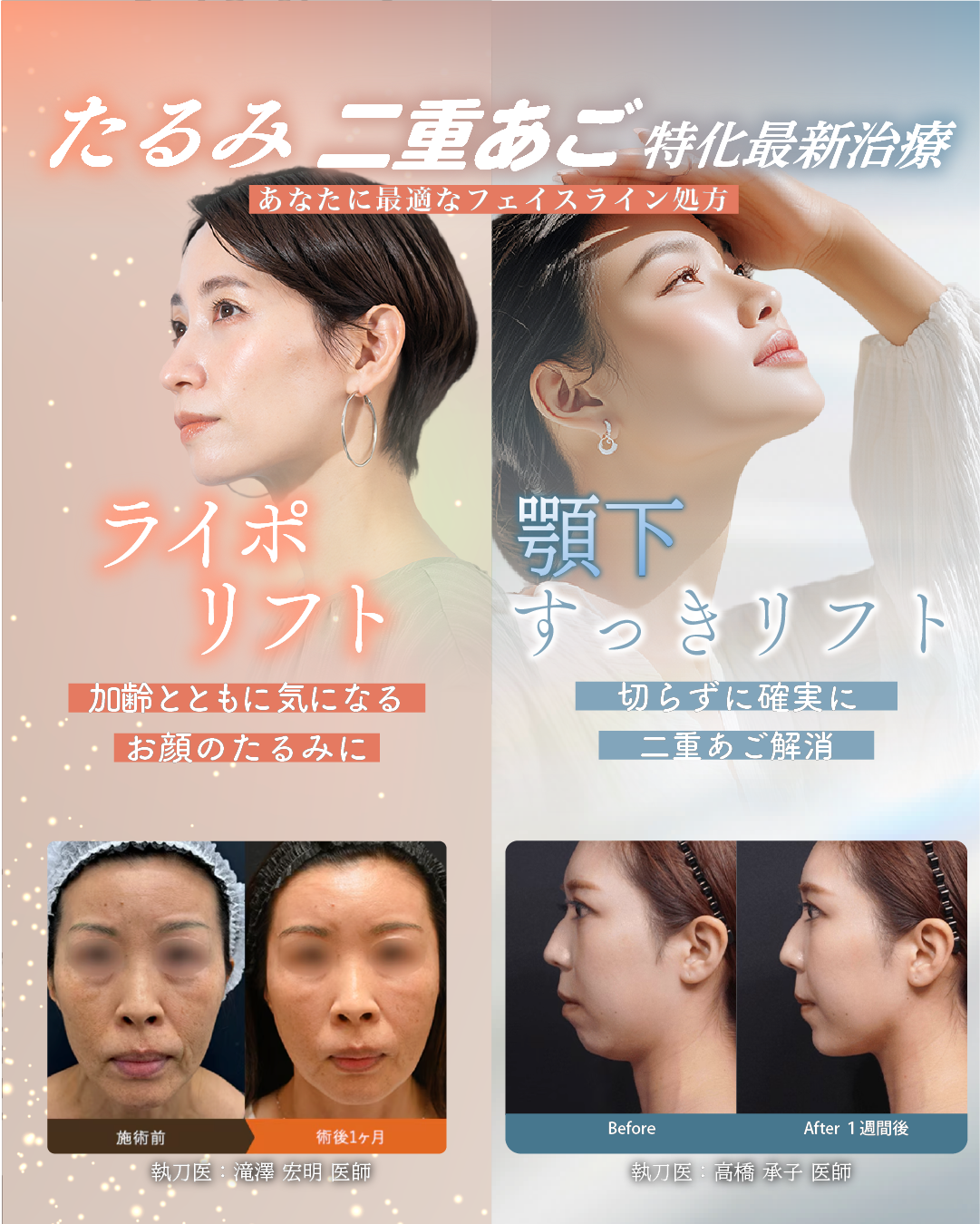 湘南美容最新リフトアップ治療