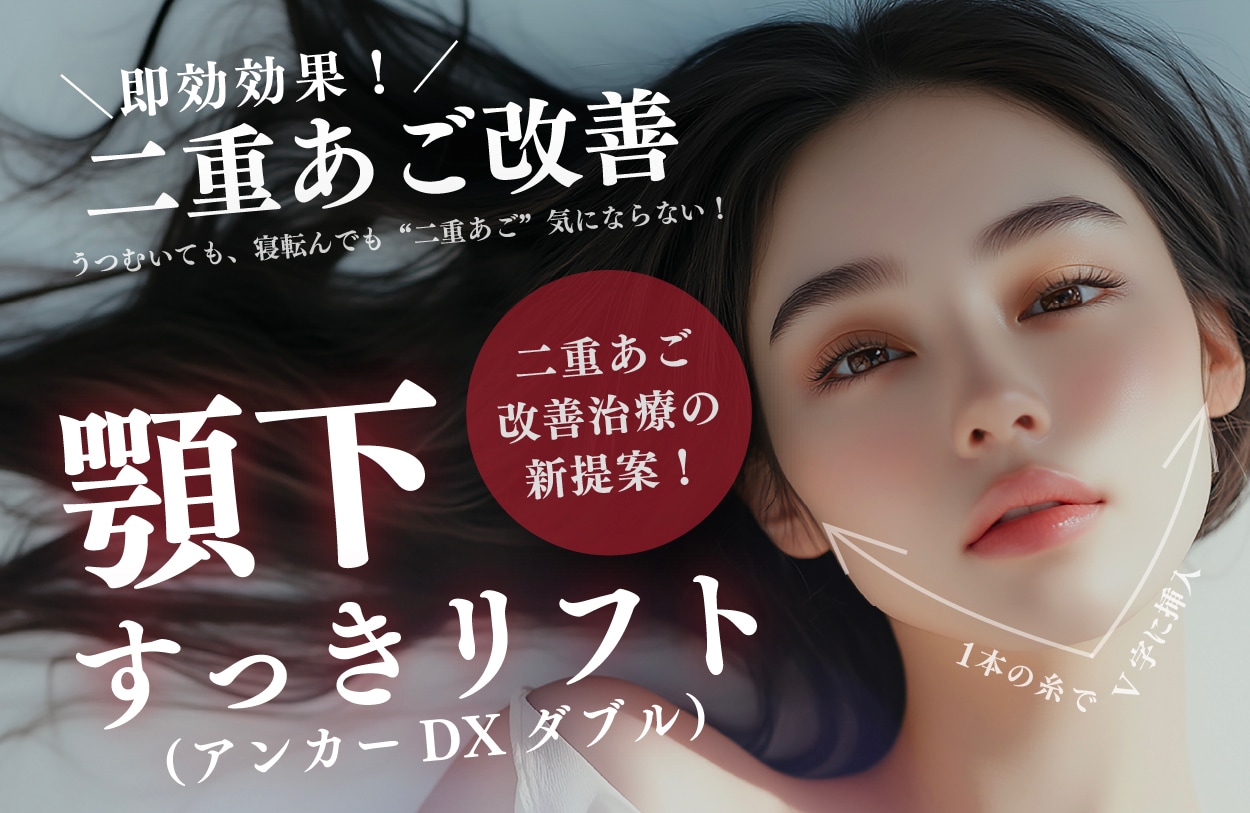 【二重あご改善】顎下すっきリフト(アンカーDXダブル)が開始‼️